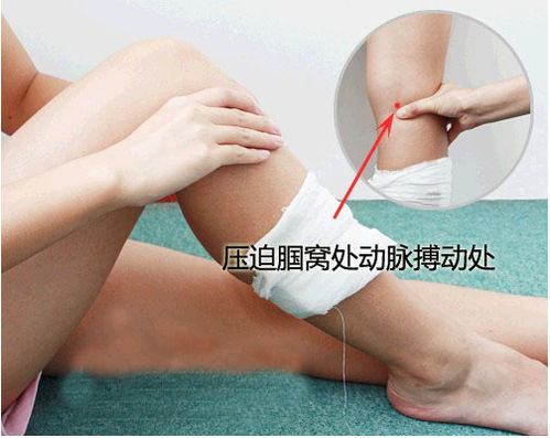 脚外伤出血急救