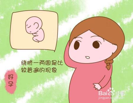 胎宝宝脐带绕颈危险大吗孕妈妈应该做些什么
