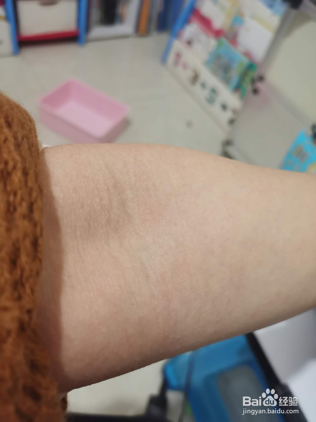 教你如何处理一般暑气。