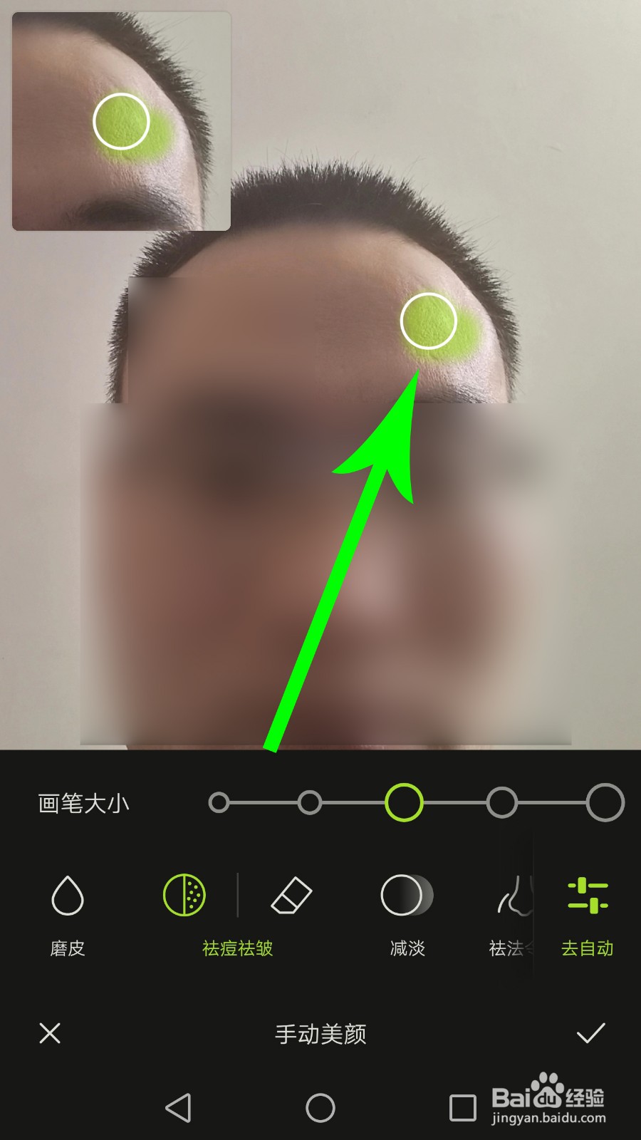 醒图怎么祛痘祛皱