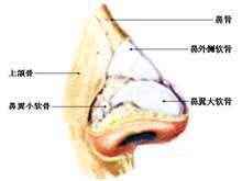 鼻骨骨折复位疗法