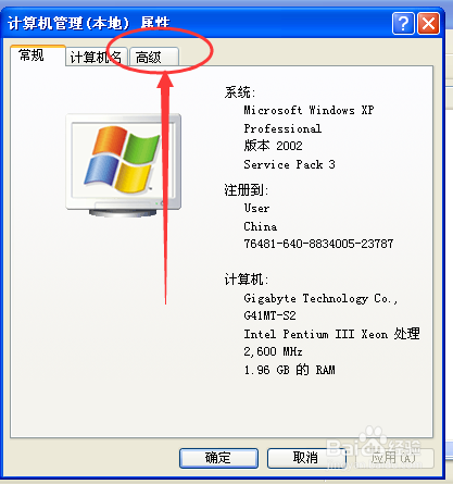 WindowsXP系统怎样设置写入调试信息