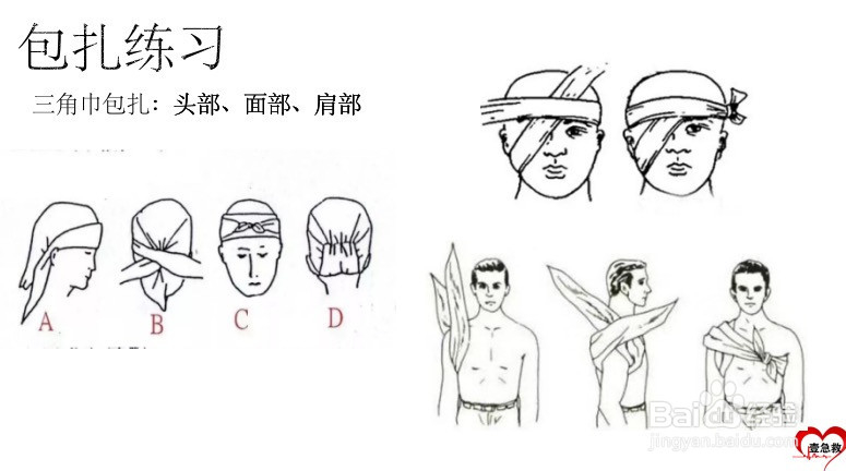 出血分类及止血、包扎