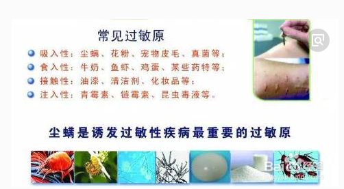 宝宝过敏怎么办?