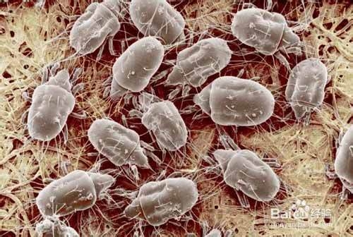 如何处理棉被上的螨虫