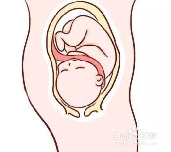 顺产好还是剖腹产好