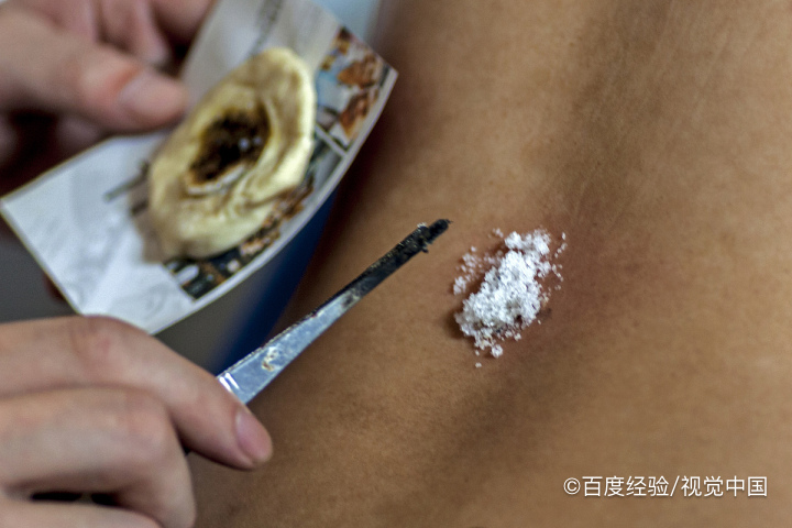 怎么排出体内浊气