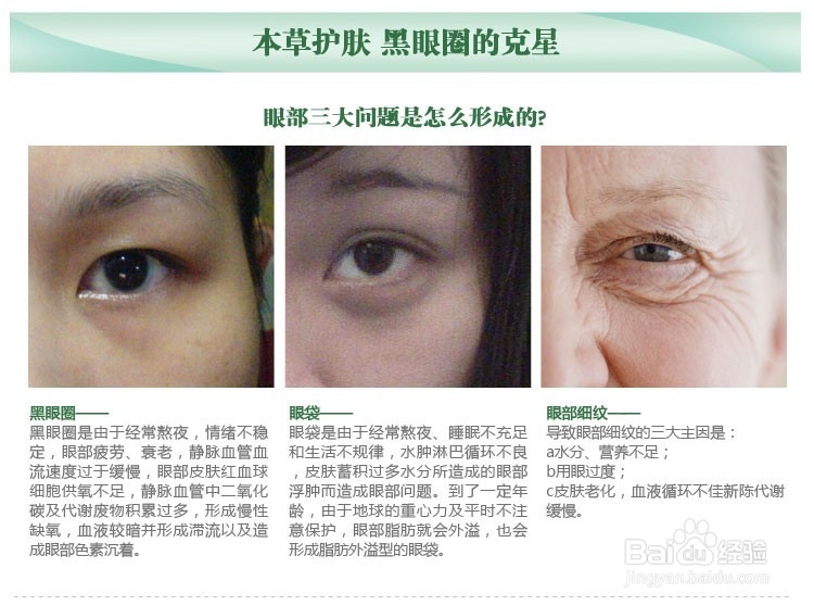 怎样去除眼袋