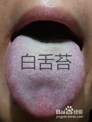 中医胃症有哪几个类型、其主要临床表现是什么