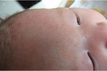 夏天带孩子要注意什么？