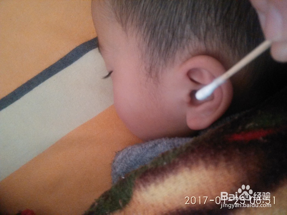 怎样给宝宝清理外耳道