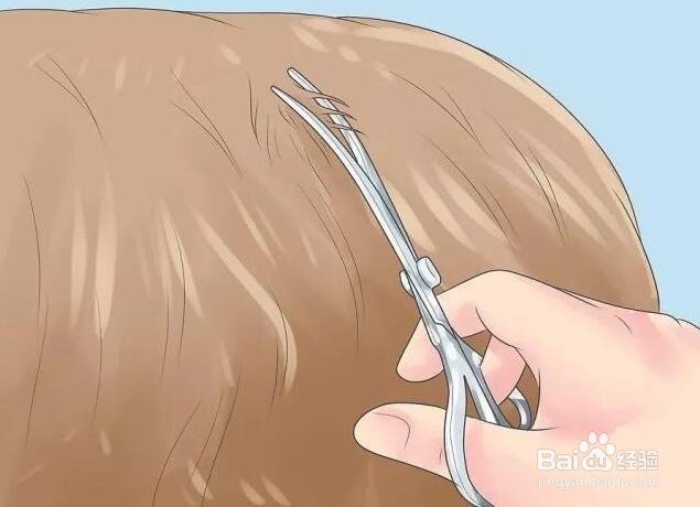 家狗被野狗咬了怎么办