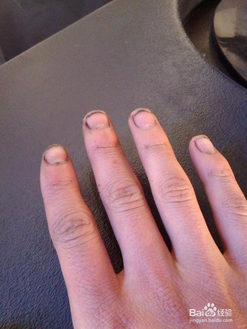 手指甲有点泛白是什么原因