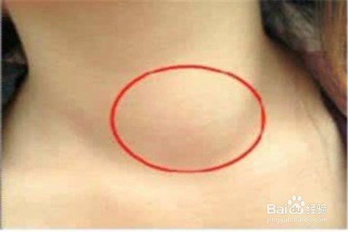 如何食用合格碘盐，预防碘缺乏病