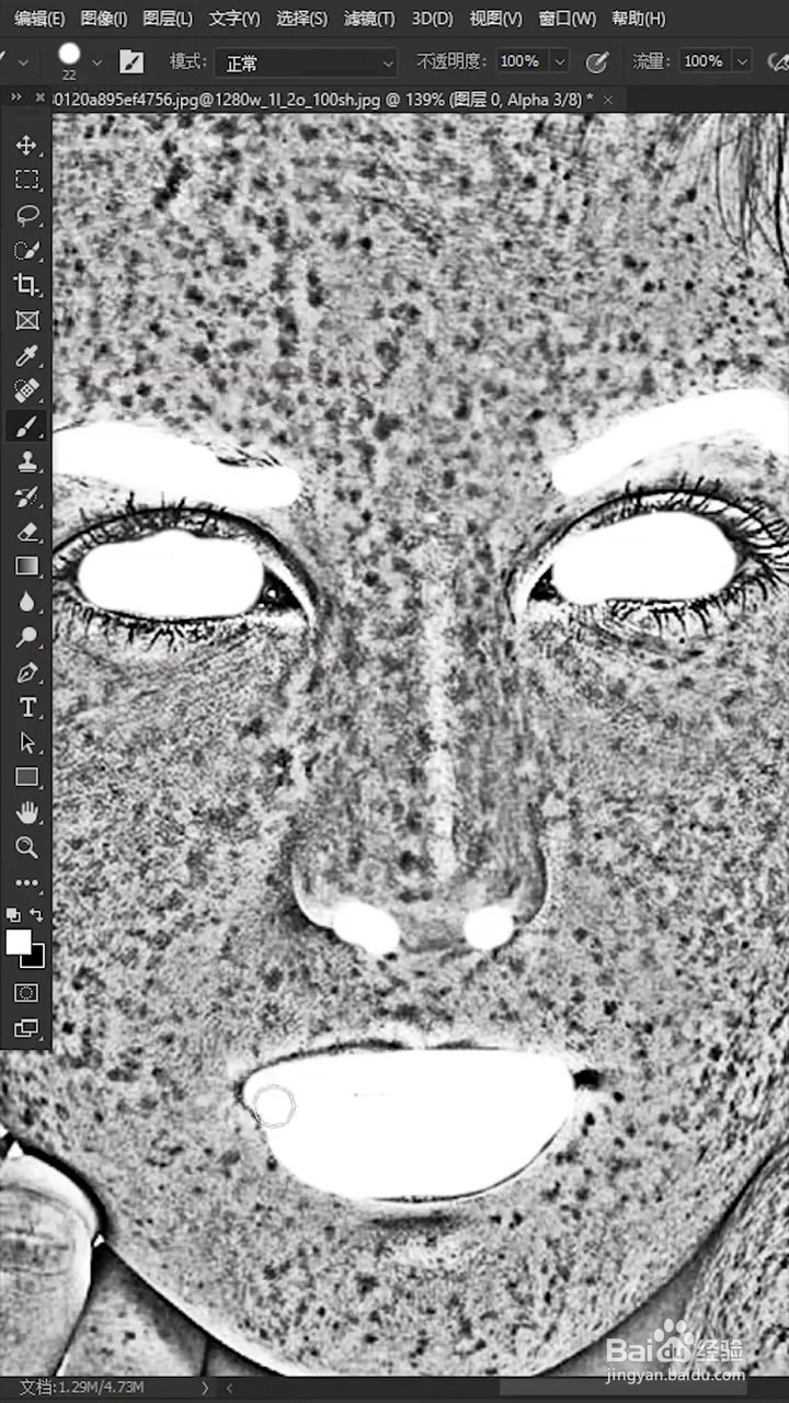 如何去除脸上的斑点