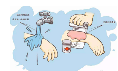 手被石锅烫了怎么处理