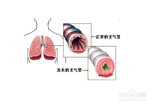 了解抽烟危害,关注身体健康