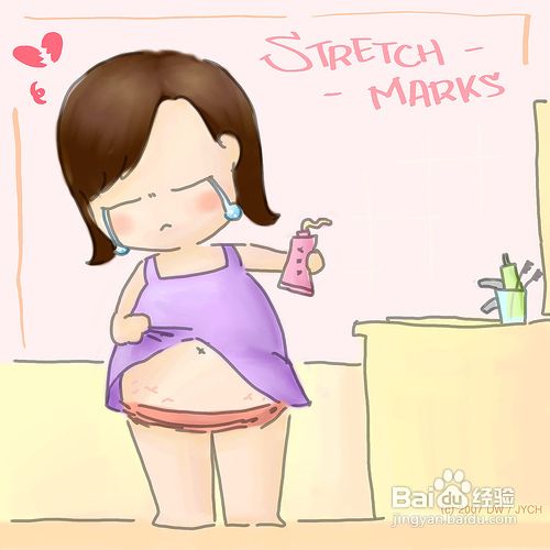 三步彻底去除产后妊娠纹