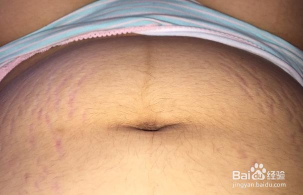 怀孕期间护肤指南