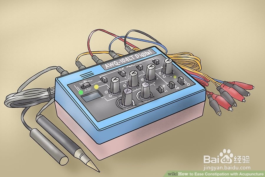 如何用针灸缓解便秘