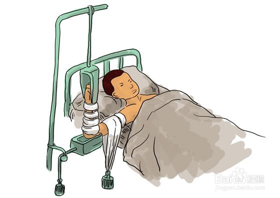 运动为什么会引起静脉血栓