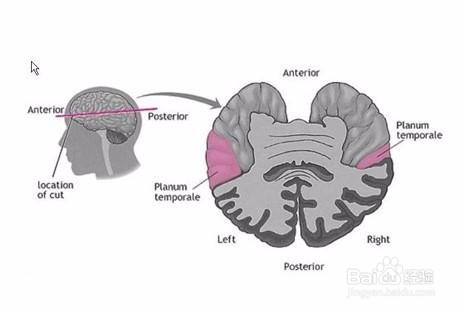 如何测试左脑和右脑的实际年龄