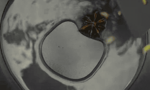 炸酱面的做法