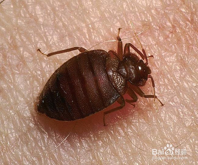 身上起红疙瘩很痒怎么办