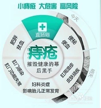 痔疮是怎么引起的