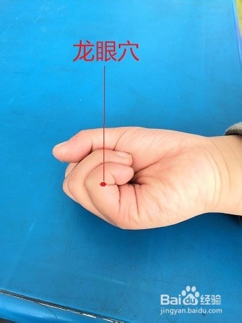缠腰火蛇的刺血疗法