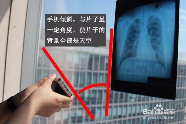 如何用手机拍照医院检查的影像片子