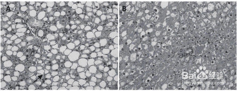 怎么看肝检验报告