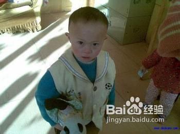 生长发育迟缓有哪些表现