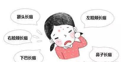 经常长痘痘怎么调理