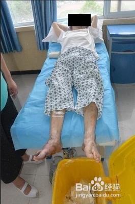 糖尿病的早期症状