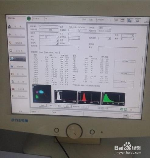 怎样用血常规检测仪