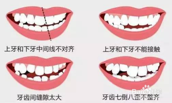 吃东西塞牙可不是小问题