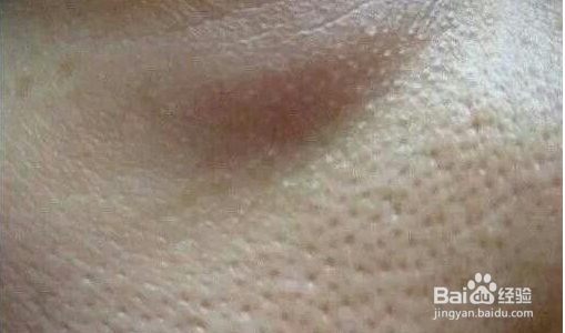 哪些坏习惯会导致毛孔越撑越大？