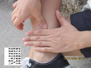 怎样去除黑眼圈？？？