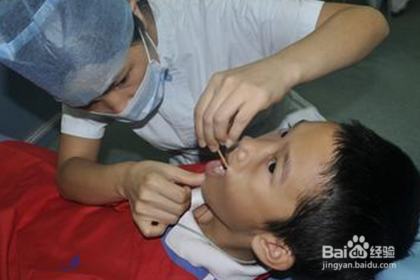 癫痫病怎么治疗