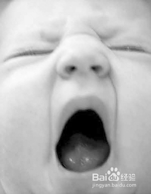 小孩子喉咙发出