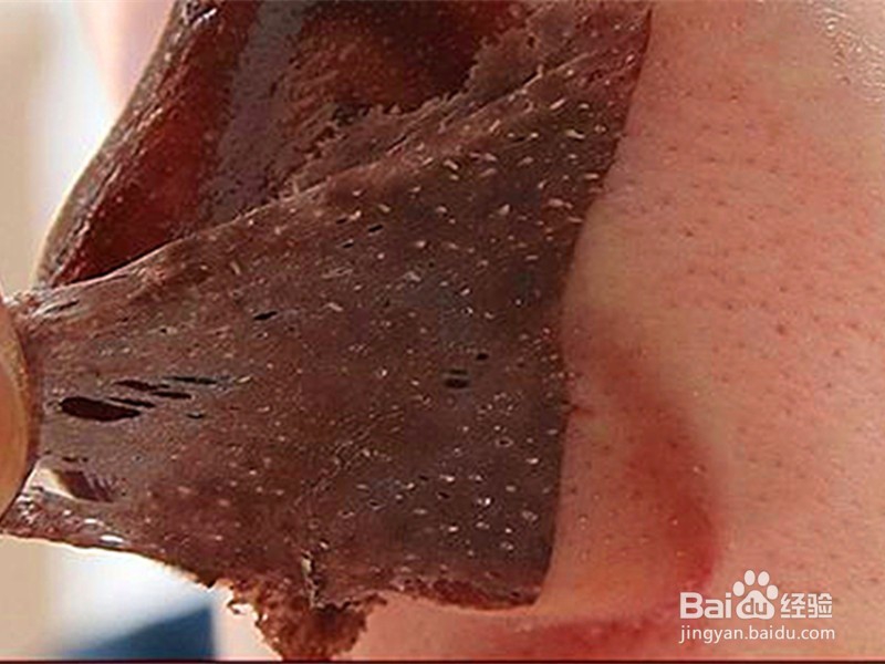 黑头导出套装效果如何