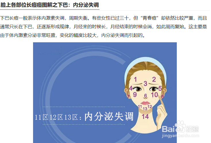 夏天快速祛痘的土方法