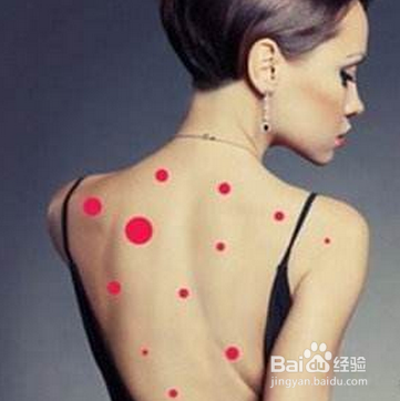 背部痘痘如何消除