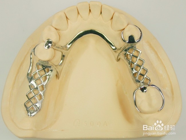 假牙的种类及价格