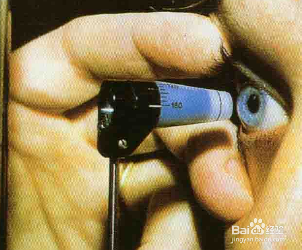 如何预防青光眼?