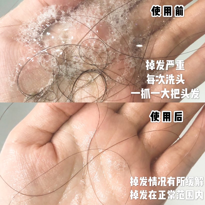 秃头少女终于有救了!!