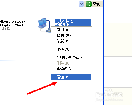 本地连接怎么自动获取IP