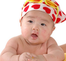 婴儿常见病及其预防