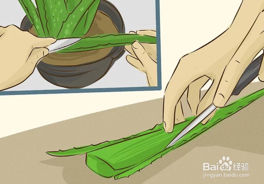 怎样用芦荟治疗灼伤？